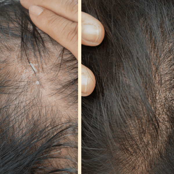 أقوى 10 أنواع زيت شعر مجربة لتكثيف الشعر خلال شهر